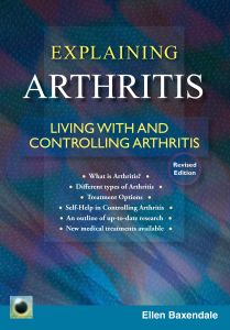 An Emerald Guide to Explaining Arthritis