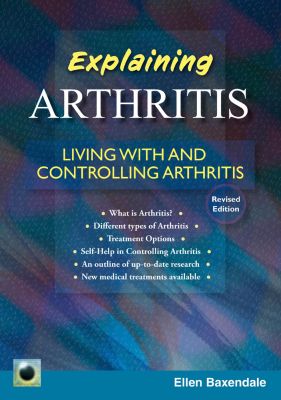 An Emerald Guide to Explaining Arthritis