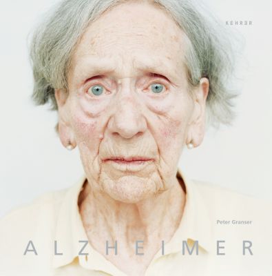 Alzheimer